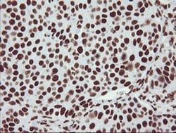 NONO Monoclonal Antibody (OTI3F8), TrueMAB , OriGene 100 &mu;L; Unconjugated:Antibodies,