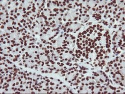 NONO Monoclonal Antibody (OTI3F8), TrueMAB , OriGene 100 &mu;L; Unconjugated:Antibodies,