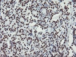 NONO Monoclonal Antibody (OTI5F1), TrueMAB , OriGene 30 &mu;L; Unconjugated:Antibodies,