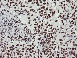 NONO Monoclonal Antibody (OTI5F1), TrueMAB , OriGene 30 &mu;L; Unconjugated:Antibodies,