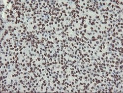 NONO Monoclonal Antibody (OTI5F1), TrueMAB , OriGene 30 &mu;L; Unconjugated:Antibodies,