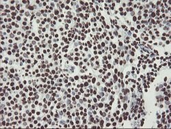 NONO Monoclonal Antibody (OTI5F1), TrueMAB , OriGene 30 &mu;L; Unconjugated:Antibodies,