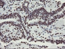 NONO Monoclonal Antibody (OTI5F1), TrueMAB , OriGene 30 &mu;L; Unconjugated:Antibodies,