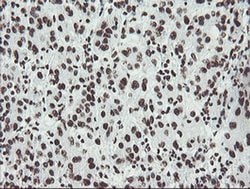 NONO Monoclonal Antibody (OTI5F1), TrueMAB , OriGene 30 &mu;L; Unconjugated:Antibodies,