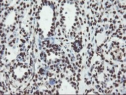 NONO Monoclonal Antibody (OTI2C9), TrueMAB , OriGene 100 &mu;L; Unconjugated:Antibodies,