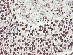 NONO Monoclonal Antibody (OTI2C9), TrueMAB , OriGene 100 &mu;L; Unconjugated:Antibodies,