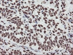 NONO Monoclonal Antibody (OTI2C9), TrueMAB , OriGene 100 &mu;L; Unconjugated:Antibodies,