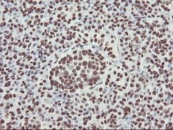 NONO Monoclonal Antibody (OTI2C9), TrueMAB , OriGene 100 &mu;L; Unconjugated:Antibodies,