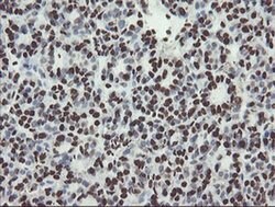 NONO Monoclonal Antibody (OTI2C9), TrueMAB , OriGene 100 &mu;L; Unconjugated:Antibodies,