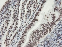 NONO Monoclonal Antibody (OTI2C9), TrueMAB , OriGene 100 &mu;L; Unconjugated:Antibodies,