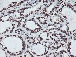 NONO Monoclonal Antibody (OTI2C9), TrueMAB , OriGene 100 &mu;L; Unconjugated:Antibodies,