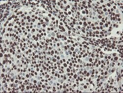 NONO Monoclonal Antibody (OTI2C9), TrueMAB , OriGene 100 &mu;L; Unconjugated:Antibodies,