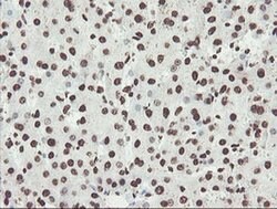 NONO Monoclonal Antibody (OTI2C9), TrueMAB , OriGene 100 &mu;L; Unconjugated:Antibodies,