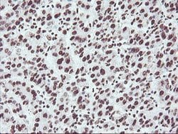 NONO Monoclonal Antibody (OTI2C9), TrueMAB , OriGene 100 &mu;L; Unconjugated:Antibodies,