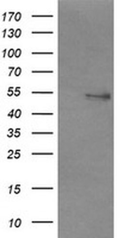 NONO Monoclonal Antibody (OTI3F8), TrueMAB , OriGene 100 &mu;L; Unconjugated:Antibodies,