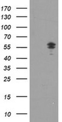 NONO Monoclonal Antibody (OTI5F1), TrueMAB , OriGene 30 &mu;L; Unconjugated:Antibodies,