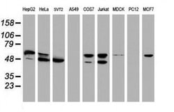 NONO Monoclonal Antibody (OTI5F1), TrueMAB , OriGene 30 &mu;L; Unconjugated:Antibodies,
