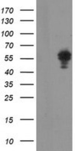 NONO Mouse anti-Canine, Human, Mouse, Rat, Clone: OTI2C9, lyophilized,