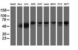 NONO Monoclonal Antibody (OTI3G4), TrueMAB , OriGene 100 &mu;L; Unconjugated:Antibodies,