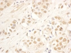 NOP58 Rabbit anti-Human, Polyclonal, Bethyl Laboratories 10 &mu;L; Unconjugated:Antibodies,