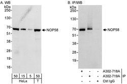NOP58 Rabbit anti-Human, Polyclonal, Bethyl Laboratories 100 &mu;L; Unconjugated:Antibodies,