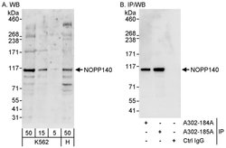 NOPP140 Rabbit anti-Human, Polyclonal, Bethyl Laboratories 100 &mu;L; Unconjugated:Antibodies,
