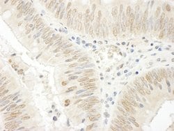 NOPP140 Polyclonal Antibody, Bethyl Laboratories 100 &mu;l; Unlabeled:Antibodies,