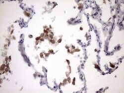 NOTCH1 Monoclonal Antibody (OTI2E7), TrueMAB , OriGene 100 &mu;L; Unconjugated:Antibodies,