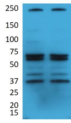 NOTCH4 Polyclonal Antibody, Invitrogen 100 μg; Unconjugated:Antibodies,