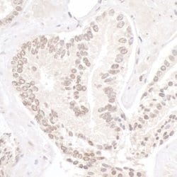 NP95/UHRF1 Rabbit anti-Human, Polyclonal, Bethyl Laboratories 100 &mu;L;