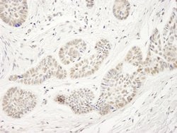 NP95/UHRF1 Polyclonal Antibody, Bethyl Laboratories 100 &mu;L | Buy Online | Bethyl Laboratories, Inc | Fisher Scientific