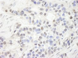 NP95/UHRF1 Polyclonal Antibody, Bethyl Laboratories 100 &mu;L | Buy Online | Bethyl Laboratories, Inc | Fisher Scientific