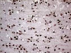 NPAS1 Mouse anti-Human, Clone: OTI4C10, lyophilized, TrueMAB 100 &mu;g;