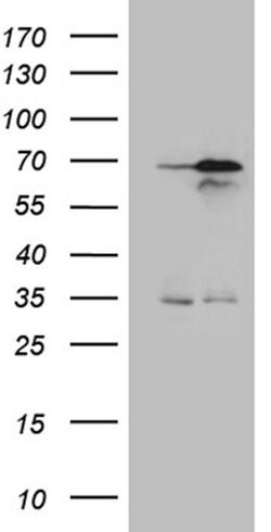 NPAS1 Mouse anti-Human, Clone: OTI1H5, lyophilized, TrueMAB 100 &mu;g;