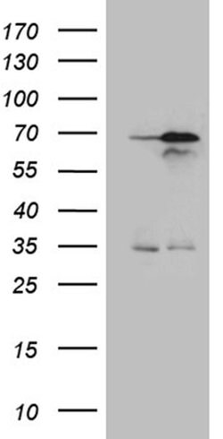 NPAS1 Monoclonal Antibody (OTI1H5), TrueMAB , OriGene 100 &mu;L; Unconjugated:Antibodies,