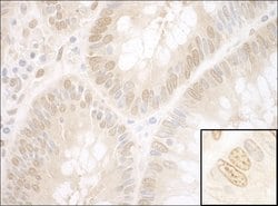 NPAT Rabbit anti-Human, Polyclonal, Bethyl Laboratories 10 &mu;L; Unconjugated:Antibodies,
