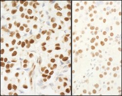 NPM1 Rabbit anti-Human, Mouse, Polyclonal, Bethyl Laboratories 100 &mu;L;