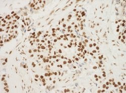 NPM1 Polyclonal Antibody, Bethyl Laboratories 100 &mu;L; Unconjugated:Antibodies,