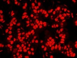 NPM1 Polyclonal Antibody, Bethyl Laboratories 100 &mu;L; Unconjugated:Antibodies,