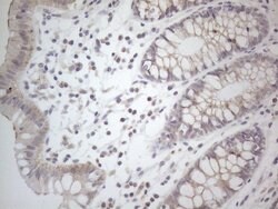 NPPB Monoclonal Antibody (OTI11G4), TrueMAB , OriGene 100 &mu;L; Unconjugated:Antibodies,