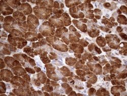 NPPB Mouse anti-Human, Clone: OTI7A8, lyophilized, TrueMAB 100 &mu;g; Unconjugated:Antibodies,