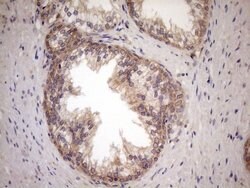 NPPB Mouse anti-Human, Clone: OTI7A8, lyophilized, TrueMAB 100 &mu;g; Unconjugated:Antibodies,