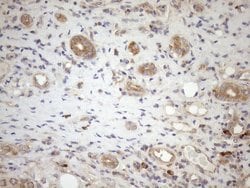 NPPB Mouse anti-Human, Clone: OTI7A8, lyophilized, TrueMAB 100 &mu;g; Unconjugated:Antibodies,