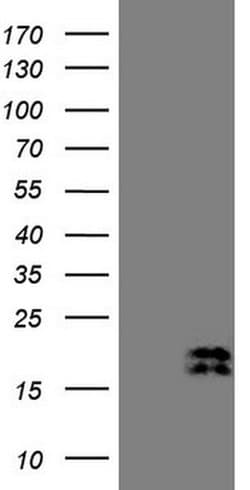 NPPB Monoclonal Antibody (OTI17A6), TrueMAB , OriGene 100 &mu;L; Unconjugated:Antibodies,