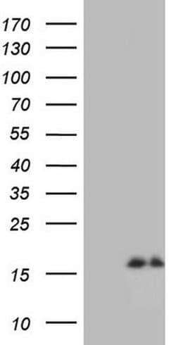 NPPB Monoclonal Antibody (OTI2C9), TrueMAB , OriGene 30 &mu;L; Unconjugated:Antibodies,