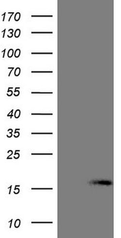 NPPB Mouse anti-Human, Clone: OTI11C3, lyophilized, TrueMAB 100 &mu;g;