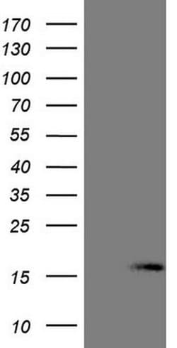 NPPB Monoclonal Antibody (OTI11C3), TrueMAB , OriGene:Antibodies:Primary