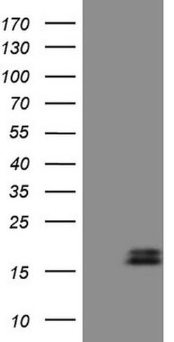 NPPB Mouse anti-Human, Clone: OTI7A8, lyophilized, TrueMAB 100 &mu;g; Unconjugated:Antibodies,