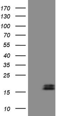 NPPB Monoclonal Antibody (OTI7A8), TrueMAB , OriGene 100 &mu;L; Unconjugated:Antibodies,