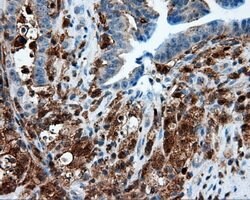NPR3 Mouse anti-Human, Clone: OTI4H1, lyophilized, TrueMAB 100 &mu;g; Unconjugated:Antibodies,